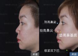 -北京米扬丽格医疗美容·联合丽格鼻整形中心