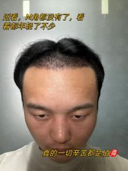 -雍禾植发全国连锁