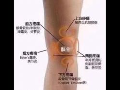 -香薇妮丝女子减肥院