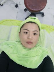 体验后-坤如玛丽·医疗美容中心