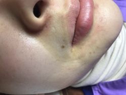 -悦己医疗美容整形线雕提升专门店