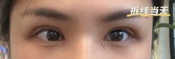 体验后-上海首尔丽格医疗美容医院