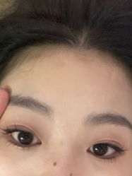 体验后-上海首尔丽格医疗美容医院