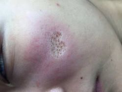 -成都军建医院·疤痕诊疗中心