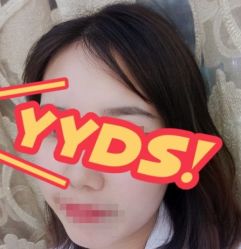 -大麦微针植发丨全国连锁