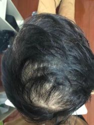 -乐绅男士高端假发定制