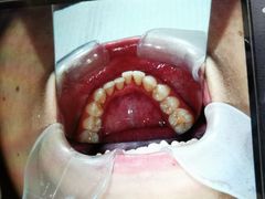 -新达口腔(华东理工大学店)