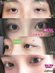 -Yestar艺星整形美容医院
