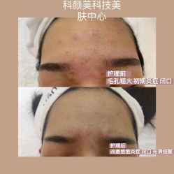 -美肤盾祛痘·问题肌头疗管理中心