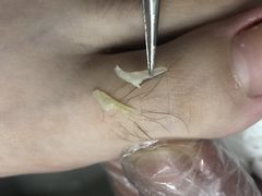 -新甲连锁灰指甲·甲沟炎·鸡眼(黑龙江路店)