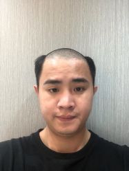 -发饰美男士增发补发假发定制店