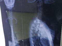 -张钰强中医正骨推拿连锁(华发商都店)