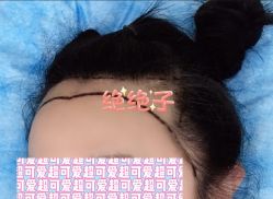 -大麦微针植发全国连锁