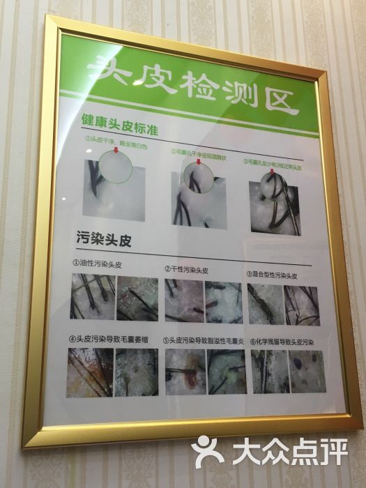 头皮检测区