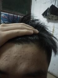 点击看大图 -悟空祛痘·亚健康皮肤管理中心