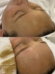 -SKIN79皮肤管理中心