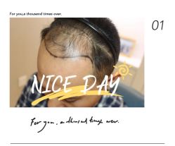 -大麦微针植发全国连锁