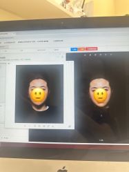 点击看大图 -Yestar艺星整形美容医院