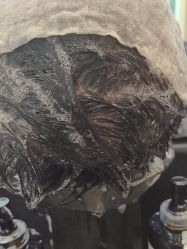 -碧莲盛·不剃发植发