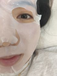 体验后-Yestar艺星医疗美容医院