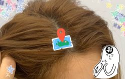 -大麦微针植发全国连锁