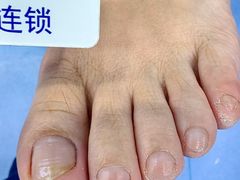 -Andrew指甲专科灰指甲·甲沟炎矫正·3D步态矫形鞋垫定制(浦三路店)