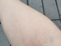 -广州仁爱天河医院体检中心