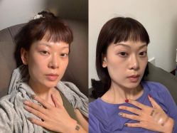 -郑荃丽格医疗美容