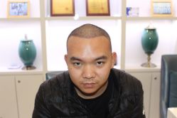 点击看大图 -大麦微针植发丨全国连锁