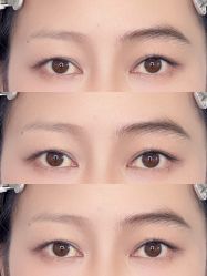 点击看大图 -杨益美学·野生眉半永久纹眉发际线