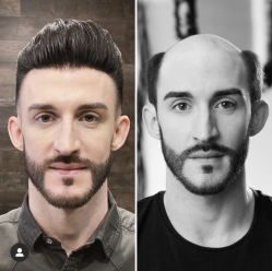 -发饰美男士增发补发假发定制店