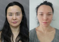 -加减美医美连锁品牌