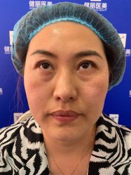 -天津健丽·去眼袋医疗美容机构