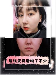 -美莱医学美容医院