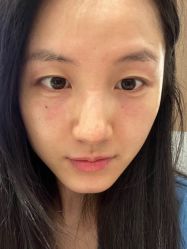-肌密·水光·祛痘·黄金微针