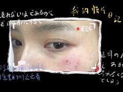 -大连市皮肤病医院