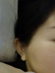 -熙朵美学植发连锁