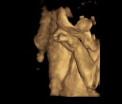 -杭州贝瑞斯美华妇儿医院·早孕·产检·儿科