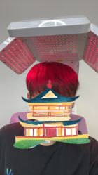 -北京雍禾植发医院