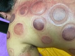 -沈师傅盲人按摩工作室(密三小区店)