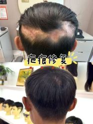 -唐风采假发补发定制