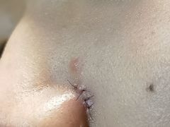 -北京大学第一医院(西城厂桥院区)