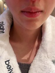 -Yestar杭州艺星医疗美容医院