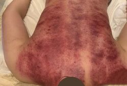 -阅年轻·AI家庭健康体质调理