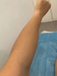 体验前-杭州医巢医疗美容