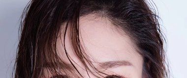 -大麦微针植发丨全国连锁