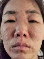 -安徽合肥韩美整形外科医院