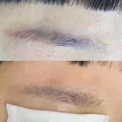 点击看大图 -莱尚·皮肤管理·痘肌护理