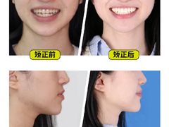 -柏乐口腔(南宁总院)