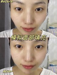 -西安壹加壹医疗美容·西北抗衰旗舰店